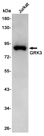 Western blot detection of GRK3 in Jurkat cell lysates using GRK3 Rabbit pAb(1:1000 diluted).Predicted band size:80KDa.Observed band size:80KDa.