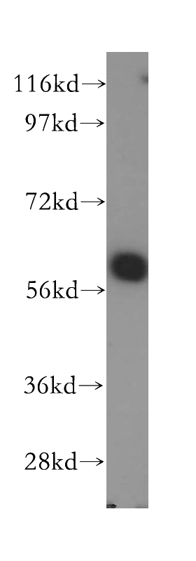 HeLa cells were subjected to SDS PAGE followed by western blot with Catalog No:115374(SLC38A3 antibody) at dilution of 1:400