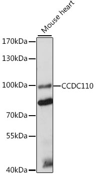 Western blot - CCDC110 Polyclonal Antibody 