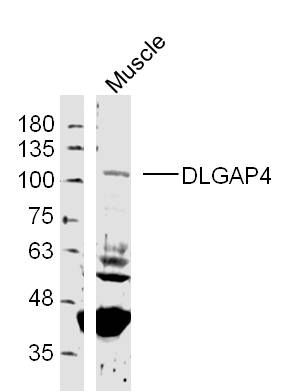 Fig1: Sample:; Muscle (Mouse) Lysate at 40 ug; Primary: Anti- DLGAP4 at 1/300 dilution; Secondary: IRDye800CW Goat Anti-Rabbit IgG at 1/20000 dilution; Predicted band size: 108 kD; Observed band size: 108 kD