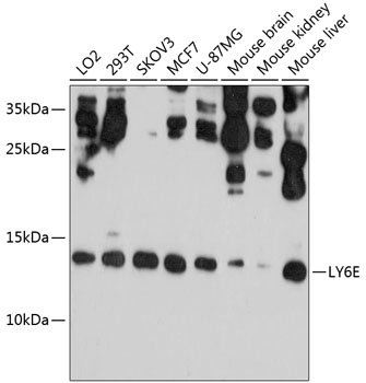 Western blot - LY6E Polyclonal Antibody 
