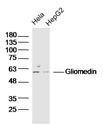 Fig1: Sample:; Hela(Human) Cell Lysate at 30 ug; HepG2(Human) Cell Lysate at 30 ug; Primary: Anti-Gliomedin at 1/300 dilution; Secondary: IRDye800CW Goat Anti-Rabbit IgG at 1/20000 dilution; Predicted band size: 59 kD; Observed band size: 59 kD