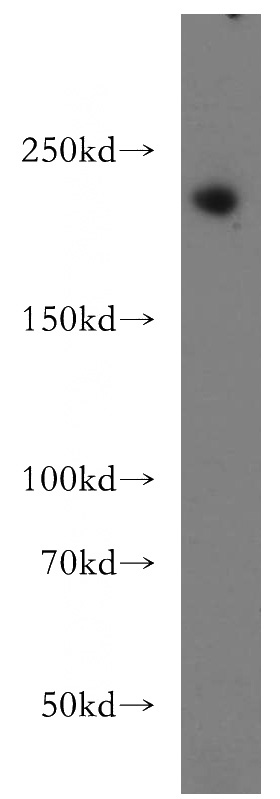 HeLa cells were subjected to SDS PAGE followed by western blot with Catalog No:114586(RB1CC1 antibody) at dilution of 1:500