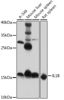 Western blot - IL1B Polyclonal Antibody. Western blot analysis of extracts of various cell lines, using IL1B antibody at 1:1000 dilution.Secondary antibody: HRP Goat Anti-Rabbit IgG at 1:10000 dilution.Lysates/proteins: 25ug per lane.Blocking buffer: 3% nonfat dry milk in TBST.Exposure time: 10s.