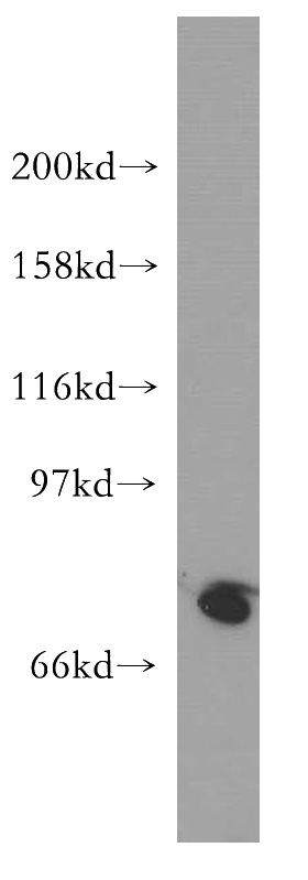 HEK-293 cells were subjected to SDS PAGE followed by western blot with Catalog No:115182(SH2D3C antibody) at dilution of 1:300