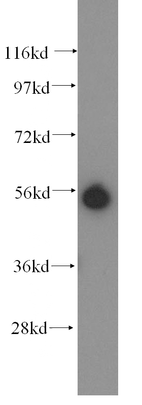 HEK-293 cells were subjected to SDS PAGE followed by western blot with Catalog No:112136(KRT81 antibody) at dilution of 1:300