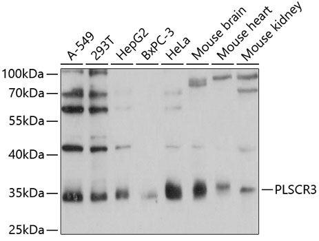 Western blot - PLSCR3 Polyclonal Antibody 