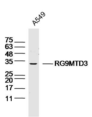 Fig1: Sample: A549 Cell (Human) Lysate at 30 ug; Primary: Anti- RG9MTD3 at 1/300 dilution; Secondary: IRDye800CW Goat Anti-Rabbit IgG at 1/20000 dilution; Predicted band size: 36kD; Observed band size: 34kD