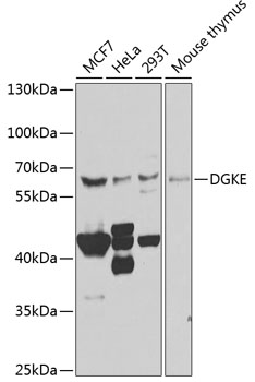 Western blot - DGKE Polyclonal Antibody 