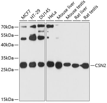 Western blot - CSN2 Polyclonal Antibody 