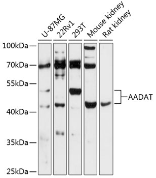 Western blot - AADAT Polyclonal Antibody 