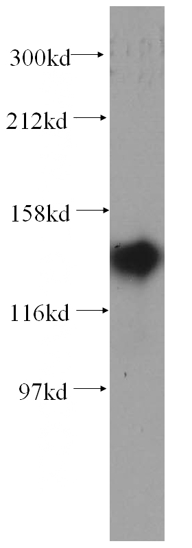 BxPC-3 cells were subjected to SDS PAGE followed by western blot with Catalog No:113301(NOMO2 antibody) at dilution of 1:300