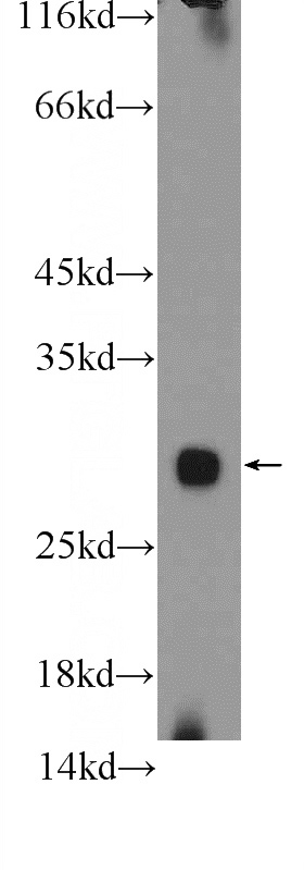 mouse testis tissue were subjected to SDS PAGE followed by western blot with Catalog No:112831(MRPL47 Antibody) at dilution of 1:300