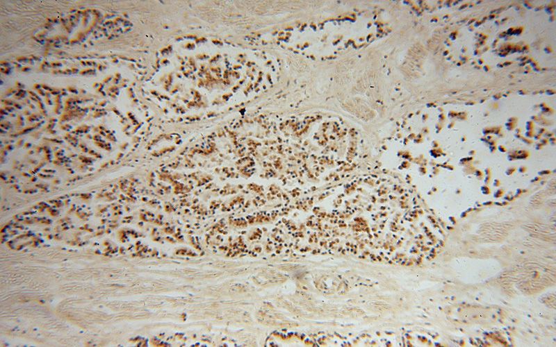 Immunohistochemical of paraffin-embedded human prostate using Catalog No:109932(DHX36 antibody) at dilution of 1:50 (under 10x lens)
