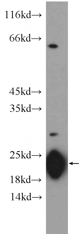rat kidney tissue were subjected to SDS PAGE followed by western blot with Catalog No:111093(GM2A Antibody) at dilution of 1:300