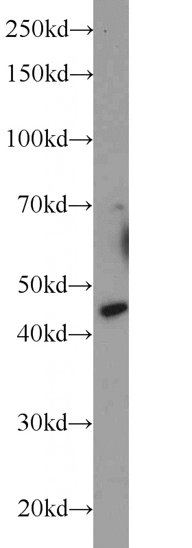 mouse brain tissue were subjected to SDS PAGE followed by western blot with Catalog No:108692(C20orf112 antibody) at dilution of 1:1000
