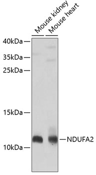 Western blot - NDUFA2 Polyclonal Antibody 