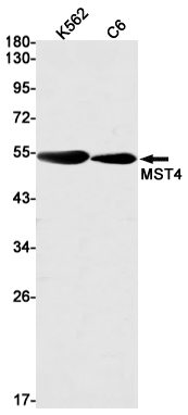 Western blot detection of MST4 in K562,C6 cell lysates using MST4 Rabbit mAb(1:1000 diluted).Predicted band size:47kDa.Observed band size:52kDa.