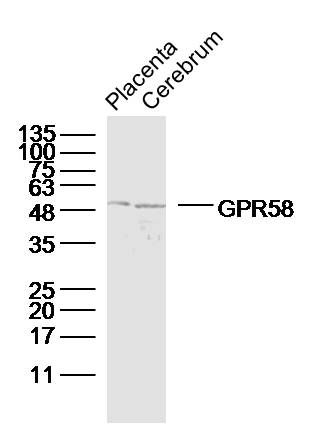 Fig2: Sample:; placenta (Mouse) Lysate at 40 ug; Cerebrum (Mouse) Lysate at 40 ug; Primary: Anti-GPR58 at 1/300 dilution; Secondary: IRDye800CW Goat Anti-Rabbit IgG at 1/20000 dilution; Predicted band size: 40 kD; Observed band size: 50 kD