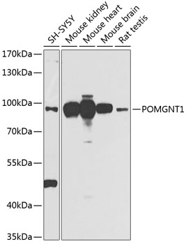Western blot - POMGNT1 Polyclonal Antibody 