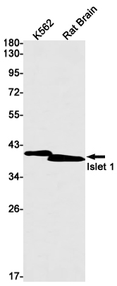 Western blot detection of Islet 1 in K562,Rat Brain lysates using Islet 1 Rabbit mAb(1:1000 diluted).Predicted band size:39kDa.Observed band size:39kDa.