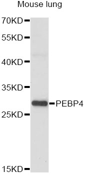 Western blot - PEBP4 Polyclonal Antibody 