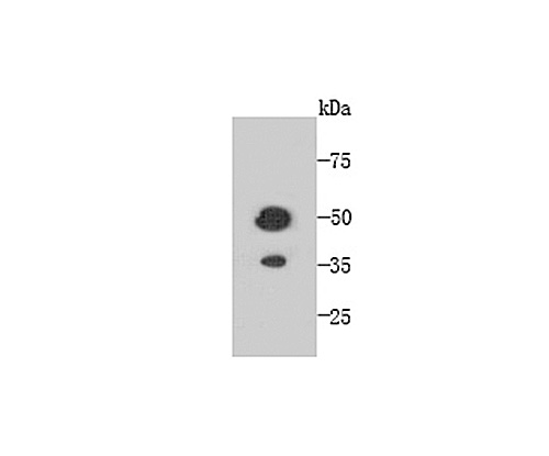 Fig1: Western blot analysis of TMEM177 on recombinant protein using anti-TMEM177 antibody at 1/1,000 dilution.