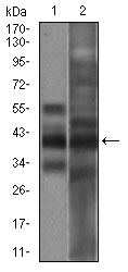Western blot analysis using EPCAM mouse mAb against A431 (1), MCF-7 (2) cell lysate.