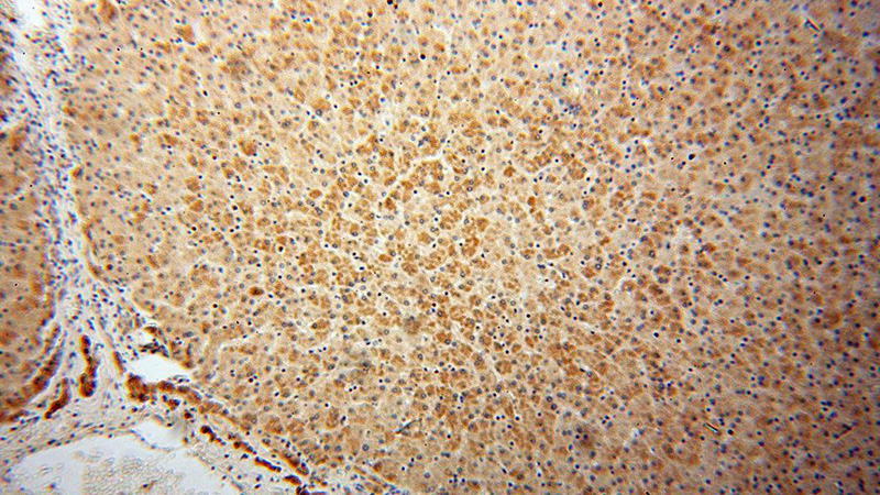 Immunohistochemical of paraffin-embedded human liver using Catalog No:109468(COQ10A antibody) at dilution of 1:100 (under 10x lens)