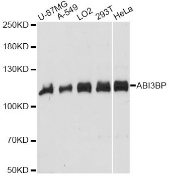 Western blot - ABI3BP Polyclonal Antibody 
