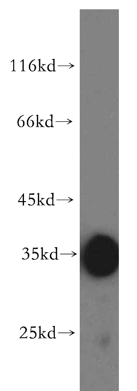 Jurkat cells were subjected to SDS PAGE followed by western blot with Catalog No:110742(FST antibody) at dilution of 1:2000