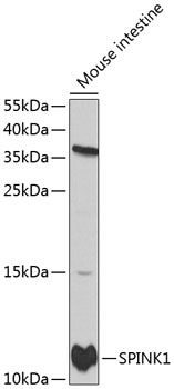 Western blot - SPINK1 Polyclonal Antibody 