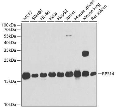 Western blot - RPS14 Polyclonal Antibody 