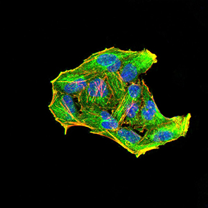 Fig4: ICC staining Rab6b (green) and Actin filaments (red) in Hela cells. The nuclear counter stain is DAPI (blue). Cells were fixed in paraformaldehyde, permeabilised with 0.25% Triton X100/PBS.