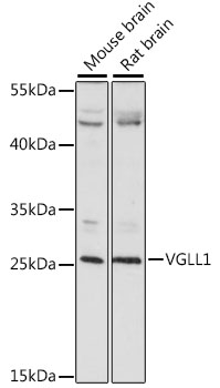 Western blot - VGLL1 Polyclonal Antibody 