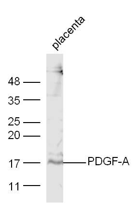 Fig3: Sample:; placenta (Mouse) Lysate at 40 ug; Primary: Anti-PDGF-A at 1/300 dilution; Secondary: IRDye800CW Goat Anti-Rabbit IgG at 1/20000 dilution; Predicted band size: 14 kD; Observed band size: 17 kD
