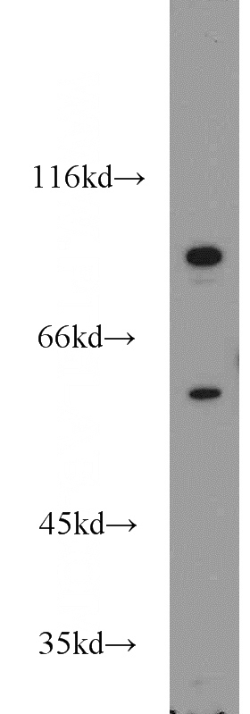 COLO 320 cells were subjected to SDS PAGE followed by western blot with Catalog No:113754(PCSK9 antibody) at dilution of 1:500
