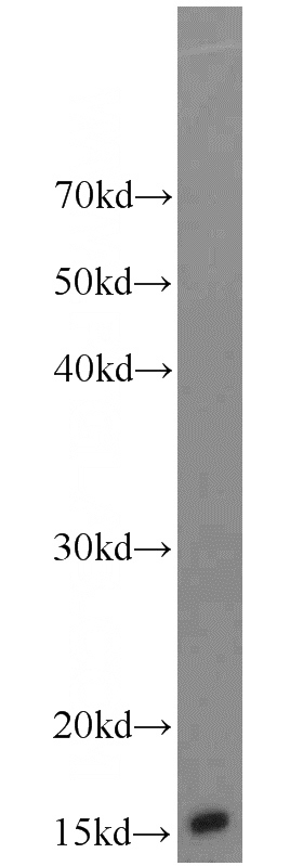 A549 cells were subjected to SDS PAGE followed by western blot with Catalog No:108352(ATP5D antibody) at dilution of 1:1000