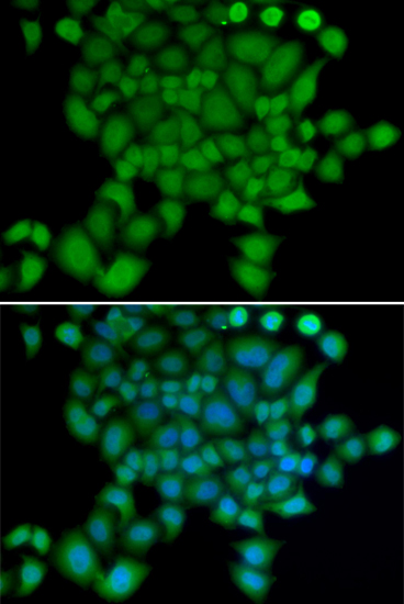 Immunofluorescence - NEDD9 Polyclonal Antibody 
