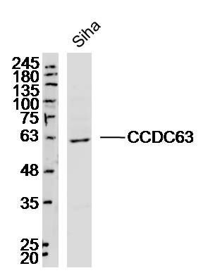 Fig1: Sample:Siha (Human)Cell Lysate at 40 ug; Primary: Anti-CCDC63 at 1/300 dilution; Secondary: IRDye800CW Goat Anti-RabbitIgG at 1/20000 dilution; Predicted band size: 66kD; Observed band size: 63kD