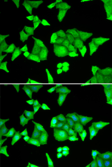 Immunofluorescence - TRIM27 Polyclonal Antibody 
