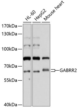Western blot - GABRR2 Polyclonal Antibody 