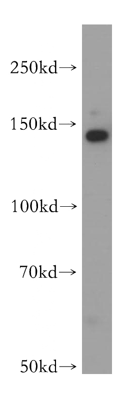 A549 cells were subjected to SDS PAGE followed by western blot with Catalog No:115142(SFI1 antibody) at dilution of 1:400