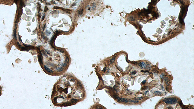 Immunohistochemistry of paraffin-embedded human placenta tissue slide using (CDH3 Antibody) at dilution of 1:500 (under 40x lens)
