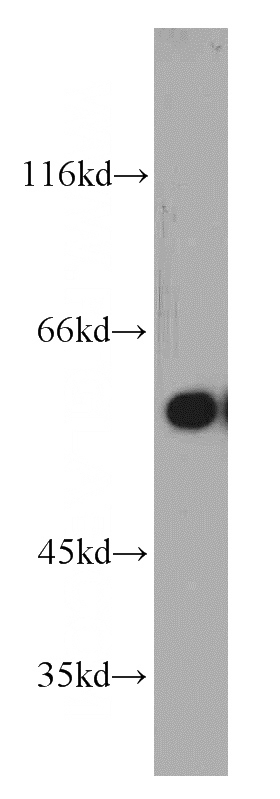 Jurkat cells were subjected to SDS PAGE followed by western blot with Catalog No:115099(DHCR24 antibody) at dilution of 1:800