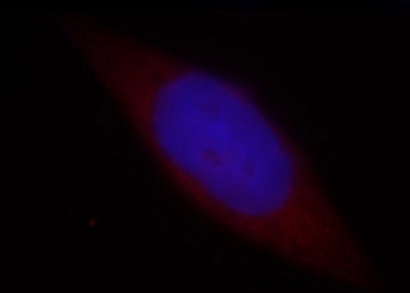 Immunofluorescent analysis of Hela cells, using SCP2 antibody Catalog No:115015 at 1:25 dilution and Rhodamine-labeled goat anti-rabbit IgG (red). Blue pseudocolor = DAPI (fluorescent DNA dye).