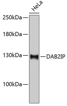 Western blot - DAB2IP Monoclonal Antibody 