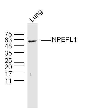 Fig1: Sample: lung (mouse) Lysate at 40 ug; Primary: Anti-NPEPL1 at 1/300 dilution; Secondary: IRDye800CW Goat Anti-Rabbit IgG at 1/20000 dilution; Predicted band size: 55 kD; Observed band size: 55 kD
