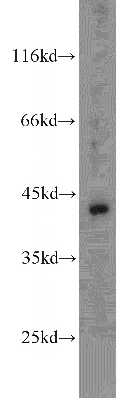 mouse brain tissue were subjected to SDS PAGE followed by western blot with Catalog No:112645(MAP2K4 antibody) at dilution of 1:300