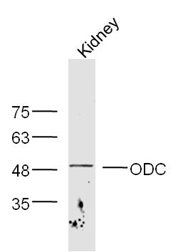 Fig4: Sample: Kidney(Mouse) lysate at 30ug;; Primary: Anti-ODC at 1:300 dilution;; Secondary: HRP conjugated Goat-Anti-rabbit IgG(bs-0295G-HRP) at 1: 5000 dilution;; Predicted band size:51 kD; Observed band size:51 kD